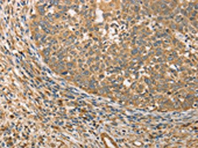 ATG3 Antibody