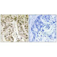HCFC1 Antibody