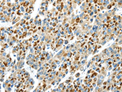 THBS2 Antibody