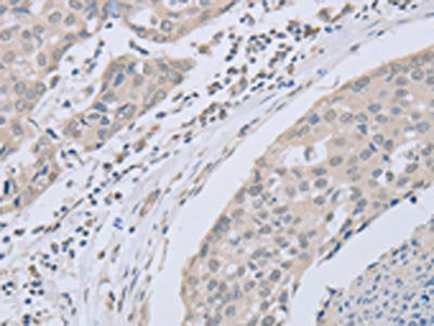 ABLIM1 Antibody