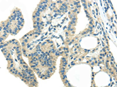 WNK3 Antibody