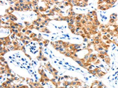 LYVE1 Antibody