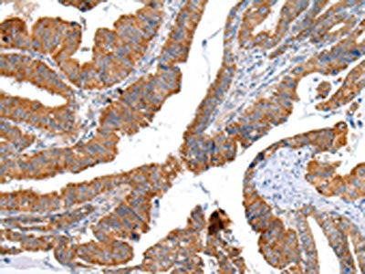 XKR4 Antibody