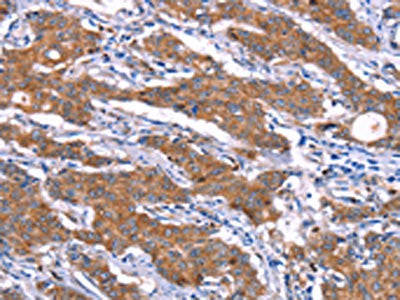 SGK2 Antibody