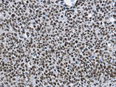 CMTM2 Antibody