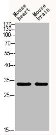 Acetyl-TAL1/2 (Lys221/222,Lys36/37) Antibody