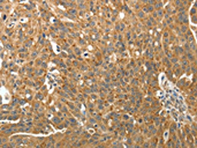RARA Antibody
