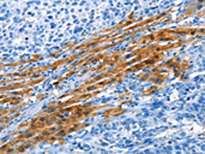 ADH4 Antibody