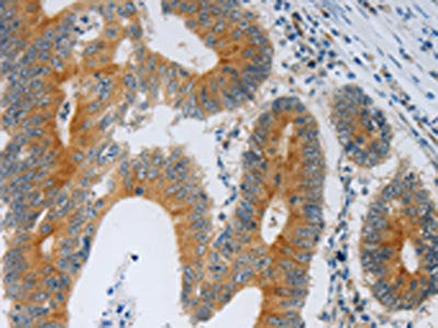 F2R Antibody
