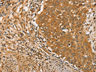 ARMCX3 Antibody