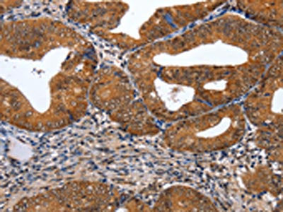 GATA6 Antibody
