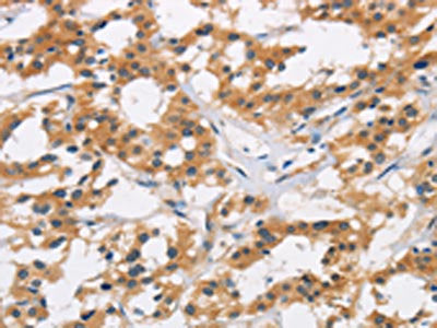 AXIN2 Antibody
