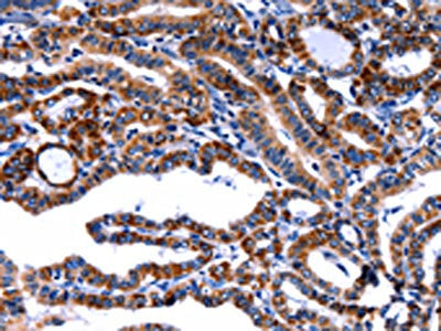 FBN1 Antibody