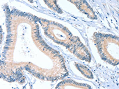 ACTL7B Antibody