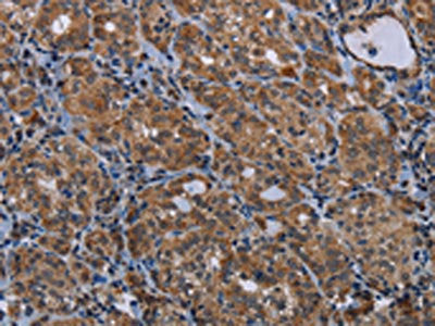 MAGEE1 Antibody