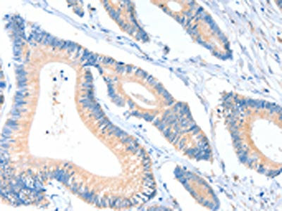 ACTR1A Antibody