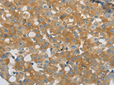 PPAP2A Antibody