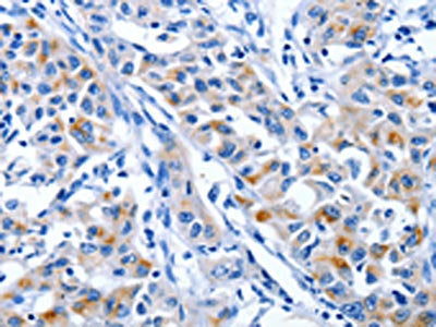 IGF2BP1 Antibody