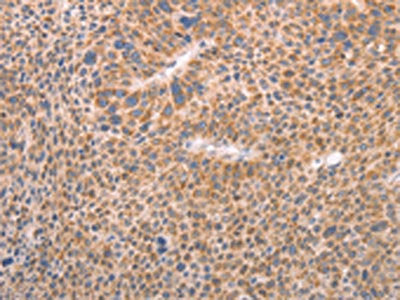 AASDHPPT Antibody