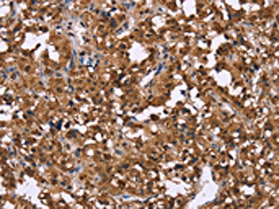 GPR171 Antibody