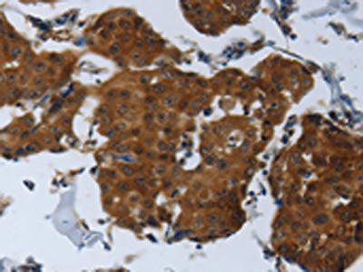 SPAG4 Antibody