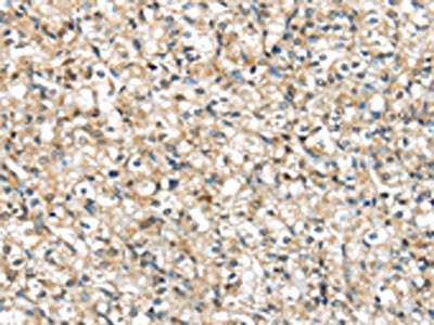 PRSS8 Antibody