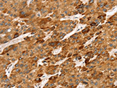 LTB Antibody