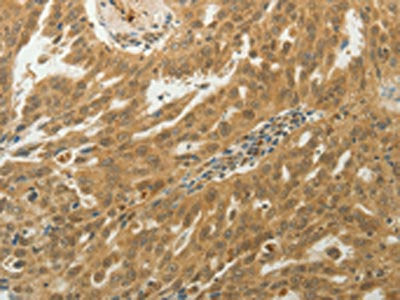 MYSM1 Antibody
