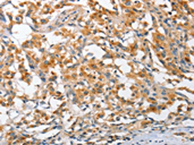 ARL8A Antibody