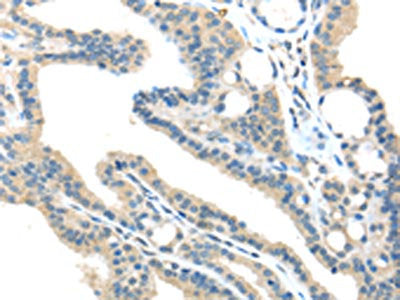 VPS36 Antibody