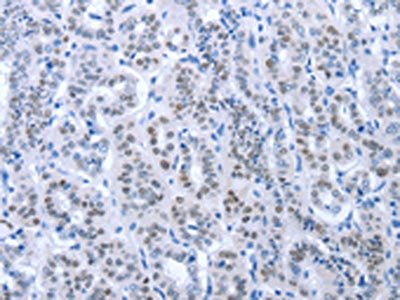 PAX8 Antibody