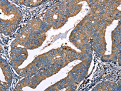 DEFA1 Antibody