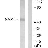 MMP1 Antibody