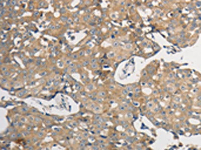 PPP2CB Antibody