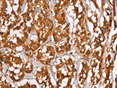 PLIN2 Antibody