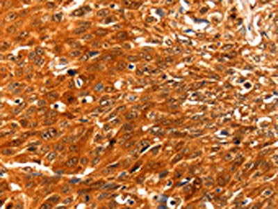 SERPINB5 Antibody