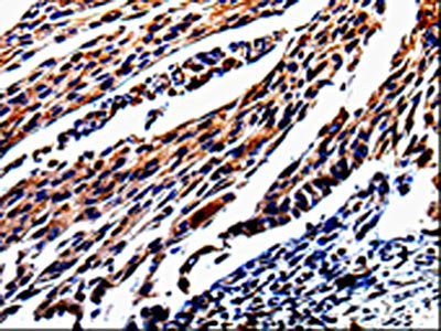 KLK3 Antibody