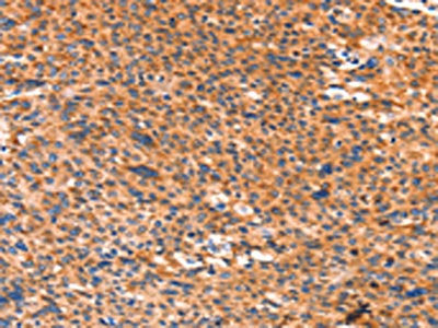 AMPD1 Antibody