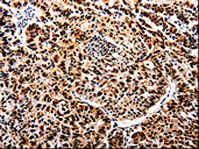 APIP Antibody