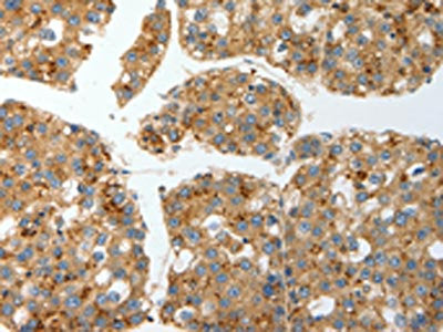 PRCP Antibody