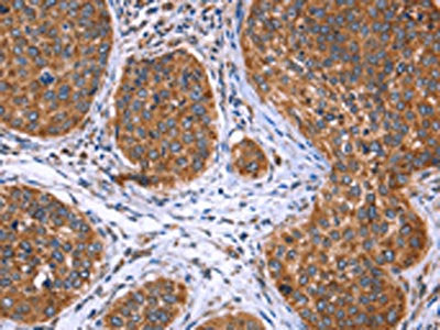 EVC2 Antibody