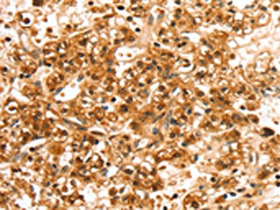 SLC44A2 Antibody