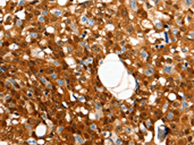 GRM4 Antibody