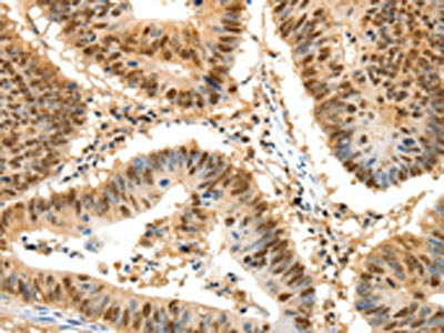 SSB Antibody