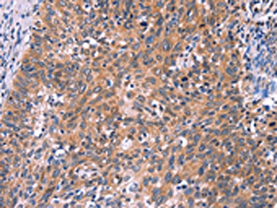 EDN1 Antibody