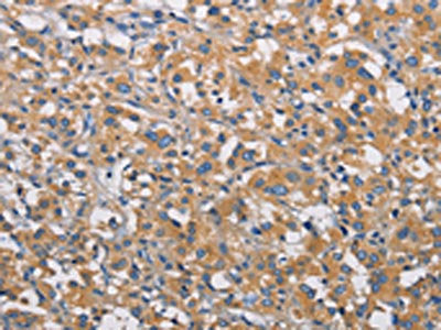 PIKFYVE Antibody