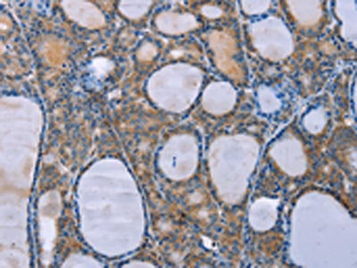 OPTN Antibody