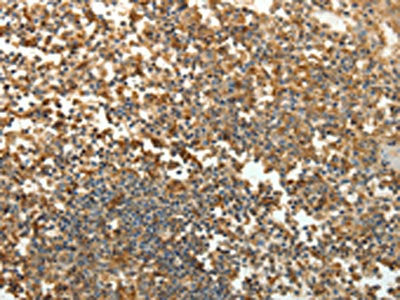 SFTPD Antibody