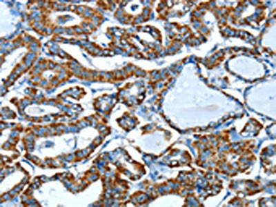 ALDH6A1 Antibody