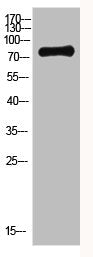 ACSS1 Antibody